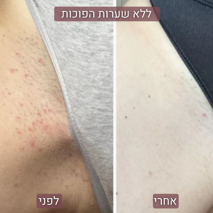 SilkPRO™ - מכונת הגילוח